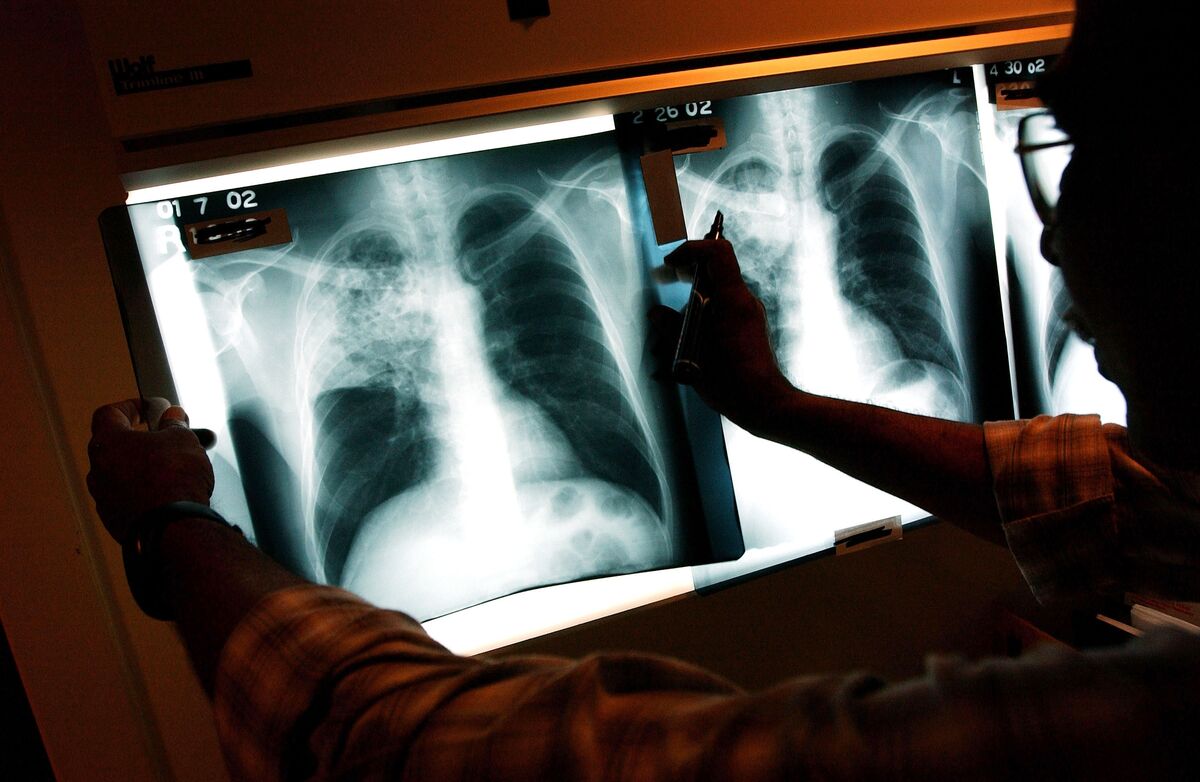 Mumbai-based Qure.AI, which uses AI to help identify and manage critical diseases at 3K+ imaging sites, raised a $65M Series D led by Lightspeed and 360 ONE (Saritha Rai/Bloomberg)