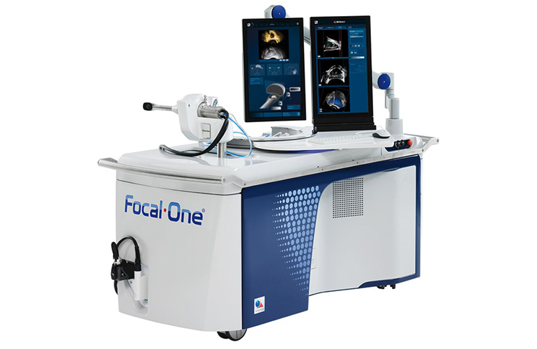 Avenda Health partners with EDAP for robotic prostate procedures