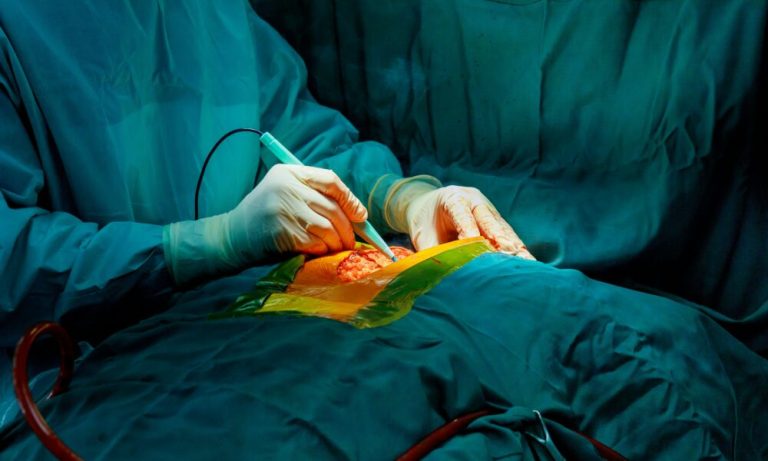 Dr. Omar Marar on the Future of Robotic-Assisted Surgery in Colorectal Procedures